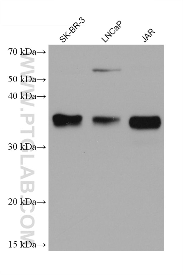 Western Blot (WB) analysis of various lysates using LGMN Monoclonal antibody (67017-1-Ig)