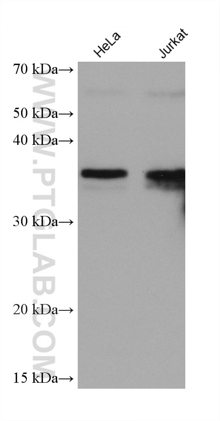 Western Blot (WB) analysis of various lysates using LGMN Monoclonal antibody (67017-1-Ig)