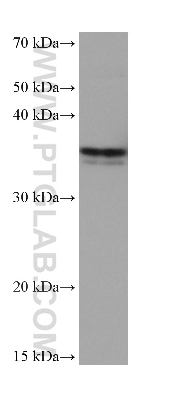 WB analysis of MCF-7 using 67017-1-Ig