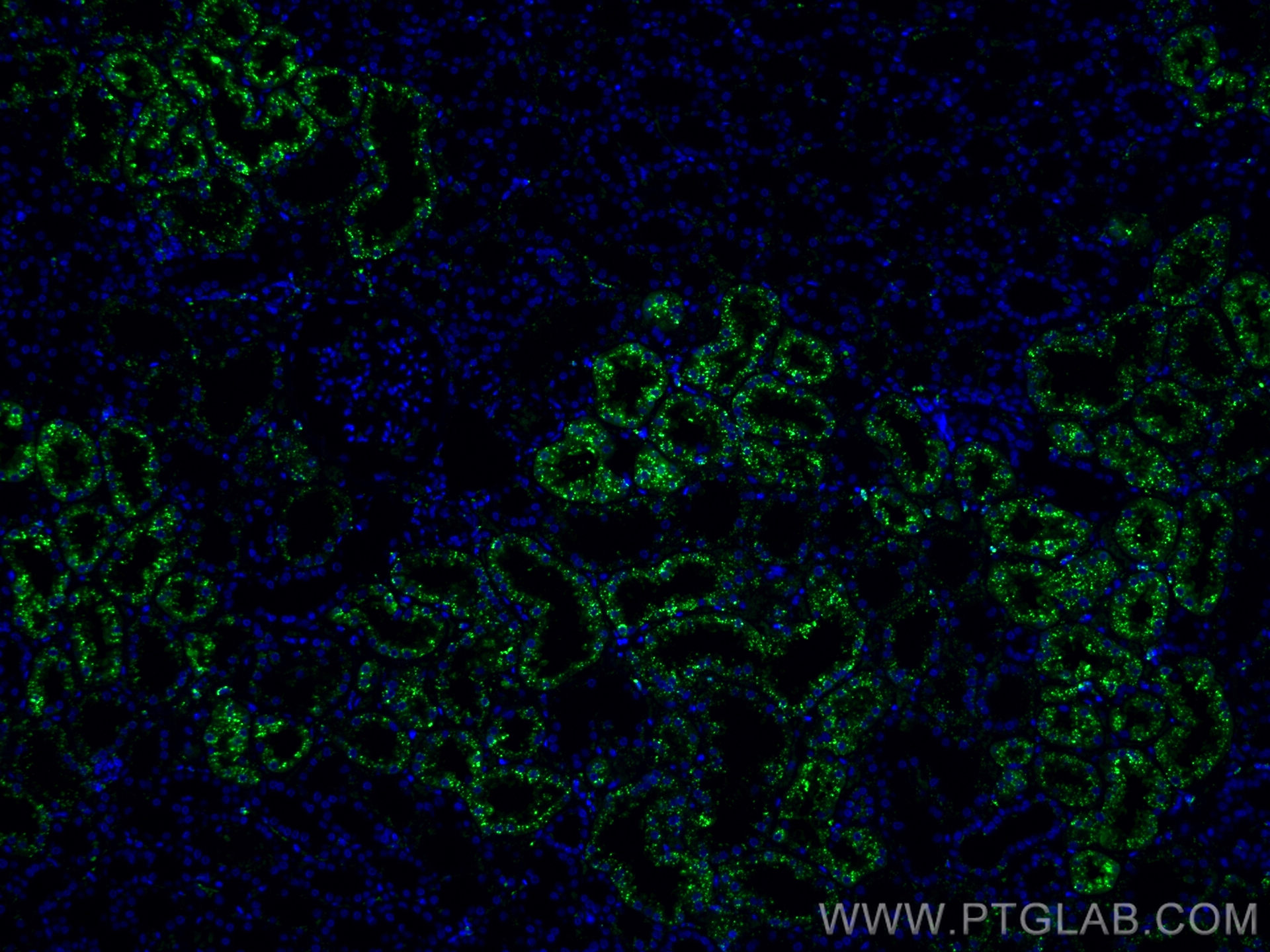 Immunofluorescence (IF) / fluorescent staining of human kidney tissue using CoraLite® Plus 488-conjugated LGMN Monoclonal anti (CL488-67017)