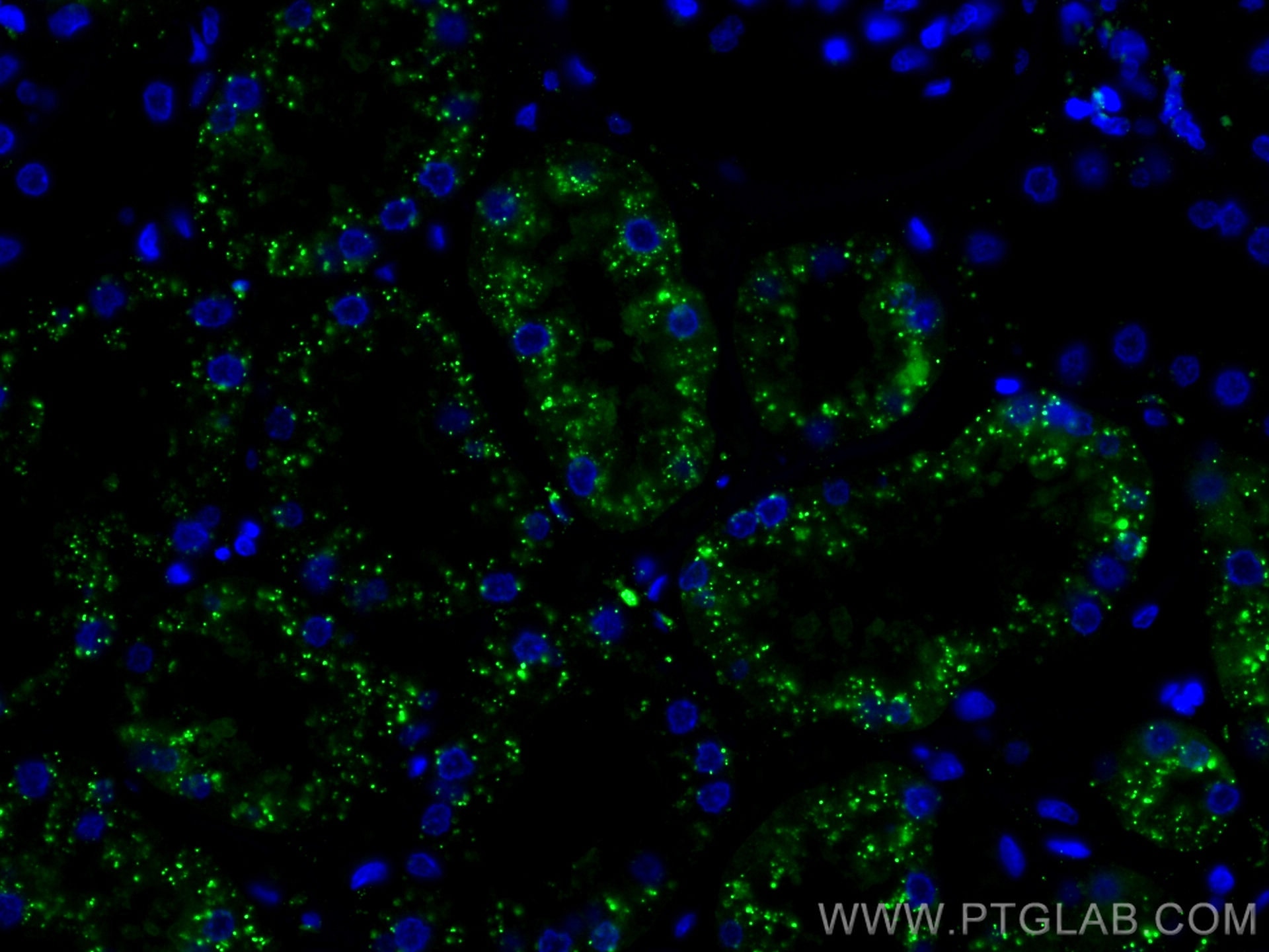 Immunofluorescence (IF) / fluorescent staining of human kidney tissue using CoraLite® Plus 488-conjugated LGMN Monoclonal anti (CL488-67017)