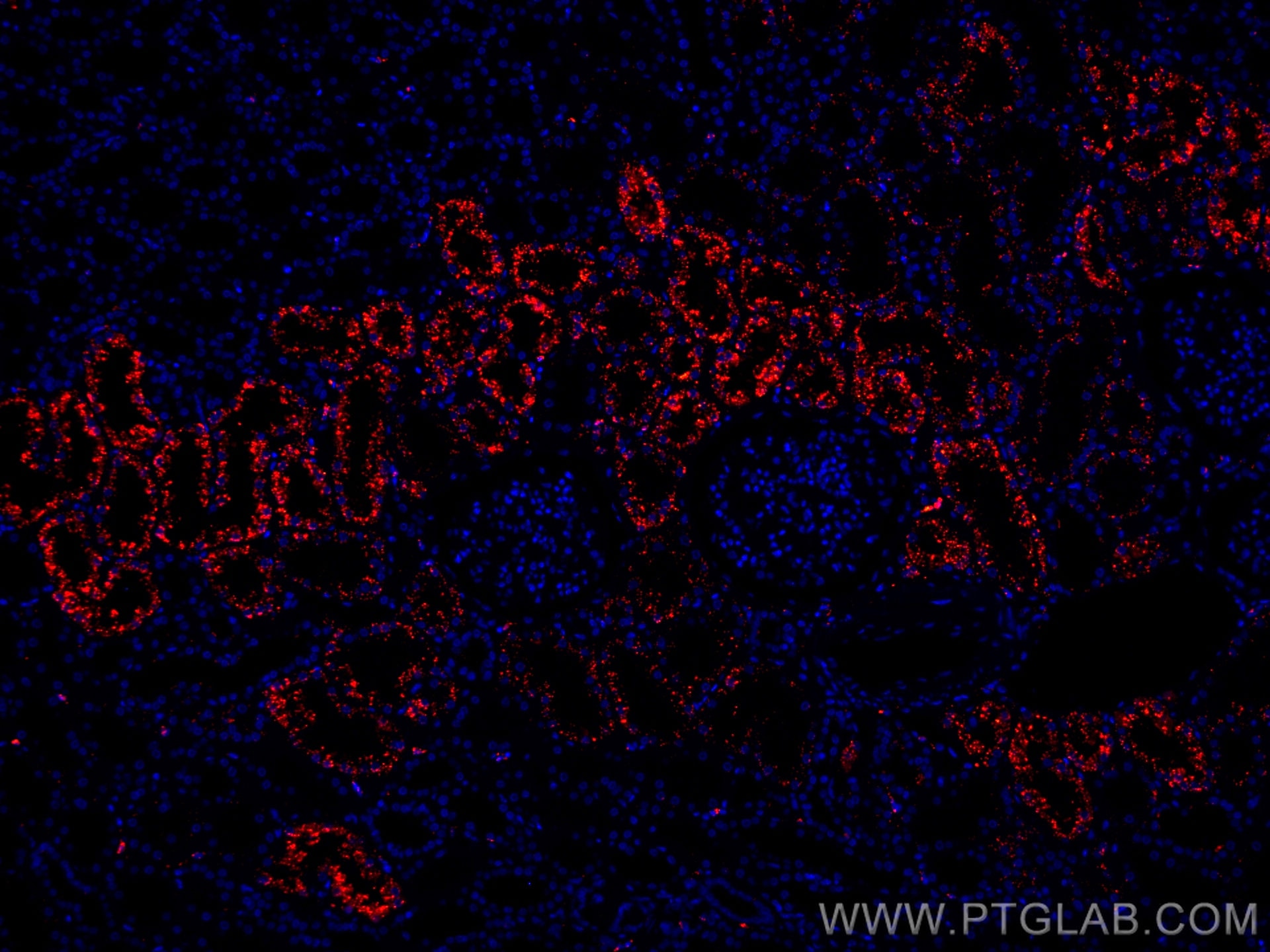 Immunofluorescence (IF) / fluorescent staining of human kidney tissue using CoraLite®594-conjugated LGMN Monoclonal antibody (CL594-67017)