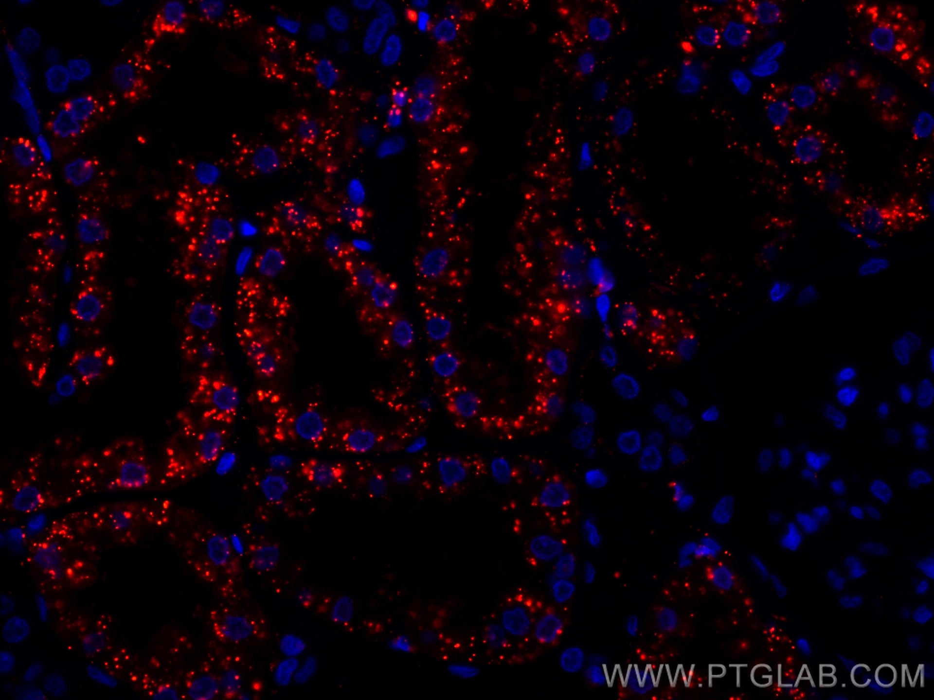 Immunofluorescence (IF) / fluorescent staining of human kidney tissue using CoraLite®594-conjugated LGMN Monoclonal antibody (CL594-67017)