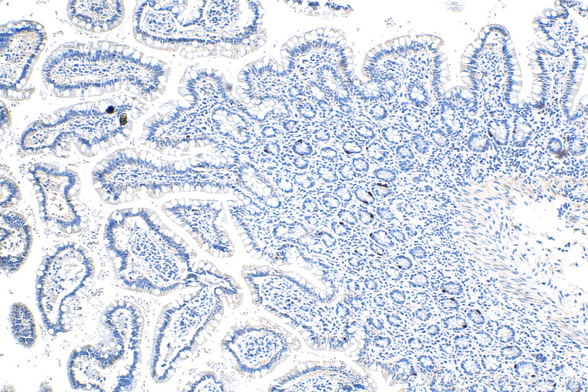 IHC staining of human small intestine using 20150-1-AP