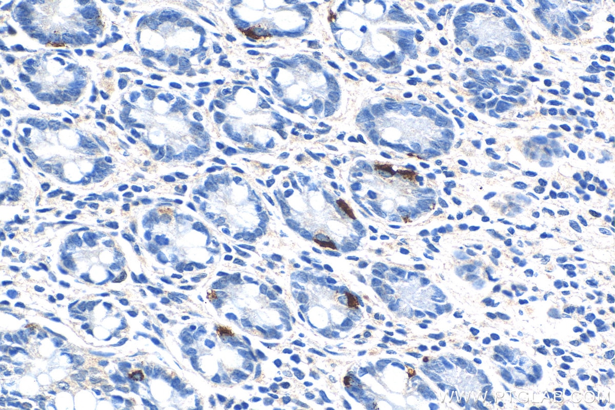 Immunohistochemistry (IHC) staining of human small intestine tissue using LGR4 Polyclonal antibody (20150-1-AP)