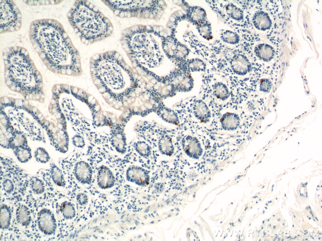 Immunohistochemistry (IHC) staining of human small intestine tissue using LGR4 Polyclonal antibody (20150-1-AP)