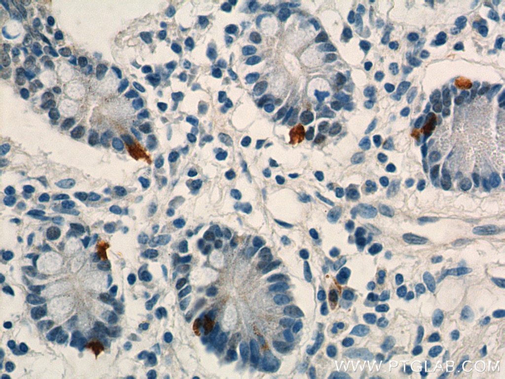 Immunohistochemistry (IHC) staining of human small intestine tissue using LGR4 Polyclonal antibody (20150-1-AP)