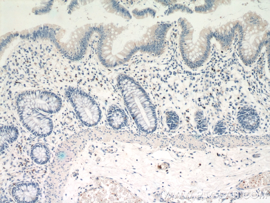 IHC staining of human colon using 21833-1-AP