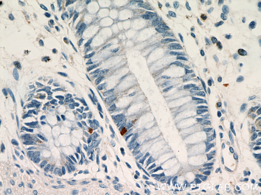 IHC staining of human colon using 21833-1-AP