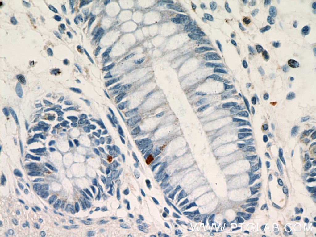 Immunohistochemistry (IHC) staining of human colon tissue using LGR5 Polyclonal antibody (21833-1-AP)