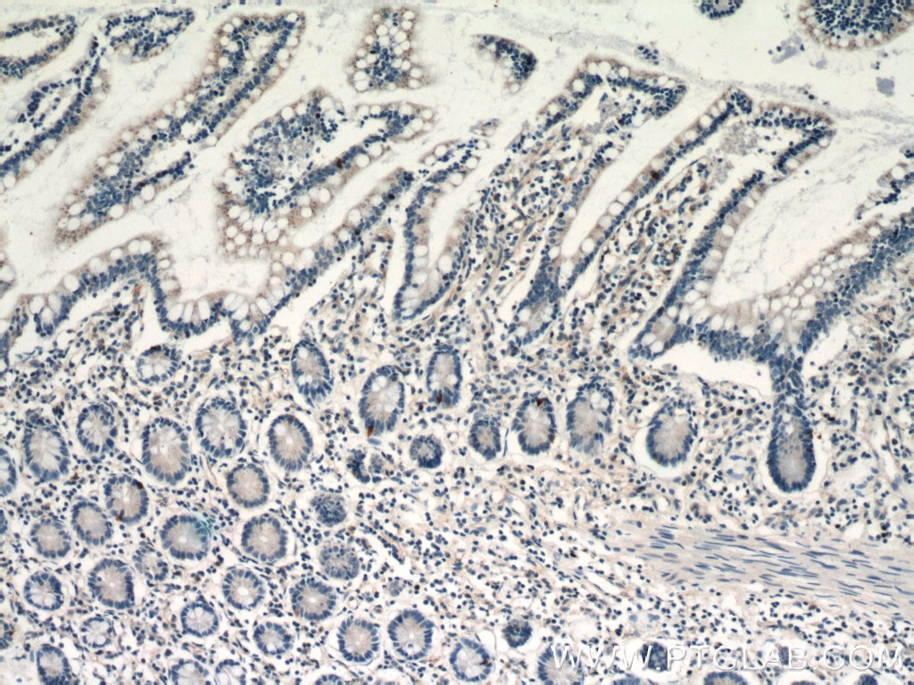 Immunohistochemistry (IHC) staining of human small intestine tissue using LGR5 Polyclonal antibody (21833-1-AP)