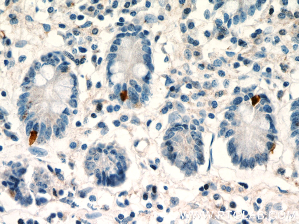 Immunohistochemistry (IHC) staining of human small intestine tissue using LGR5 Polyclonal antibody (21833-1-AP)
