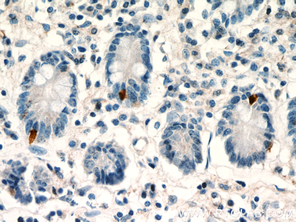 IHC staining of human small intestine using 21833-1-AP