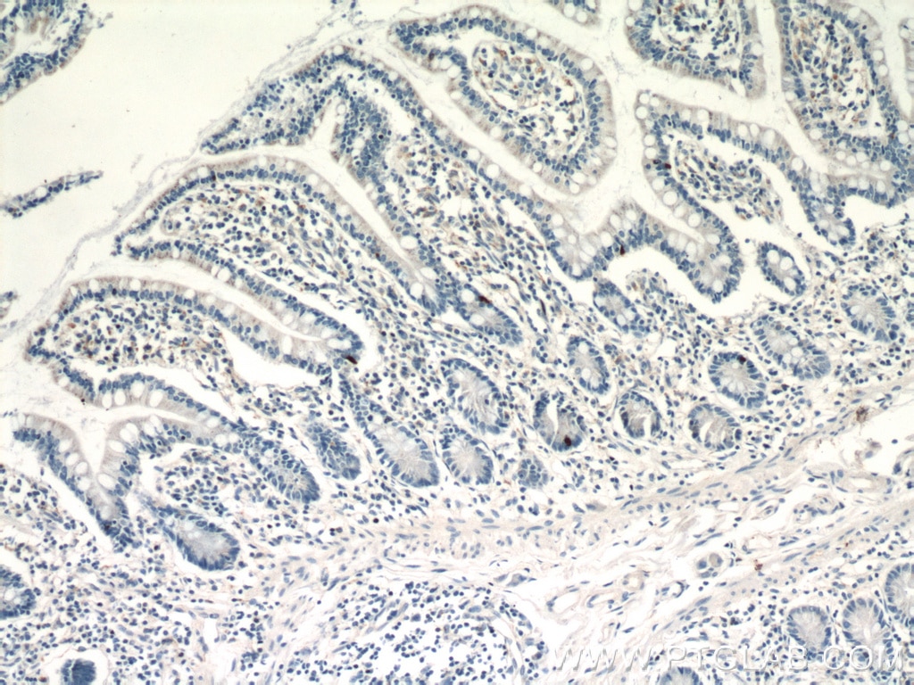 IHC staining of human small intestine using 21833-1-AP