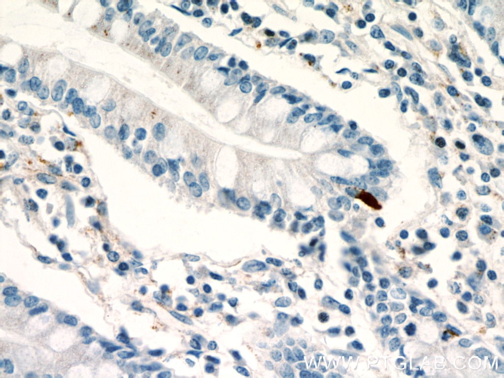 Immunohistochemistry (IHC) staining of human small intestine tissue using LGR5 Polyclonal antibody (21833-1-AP)