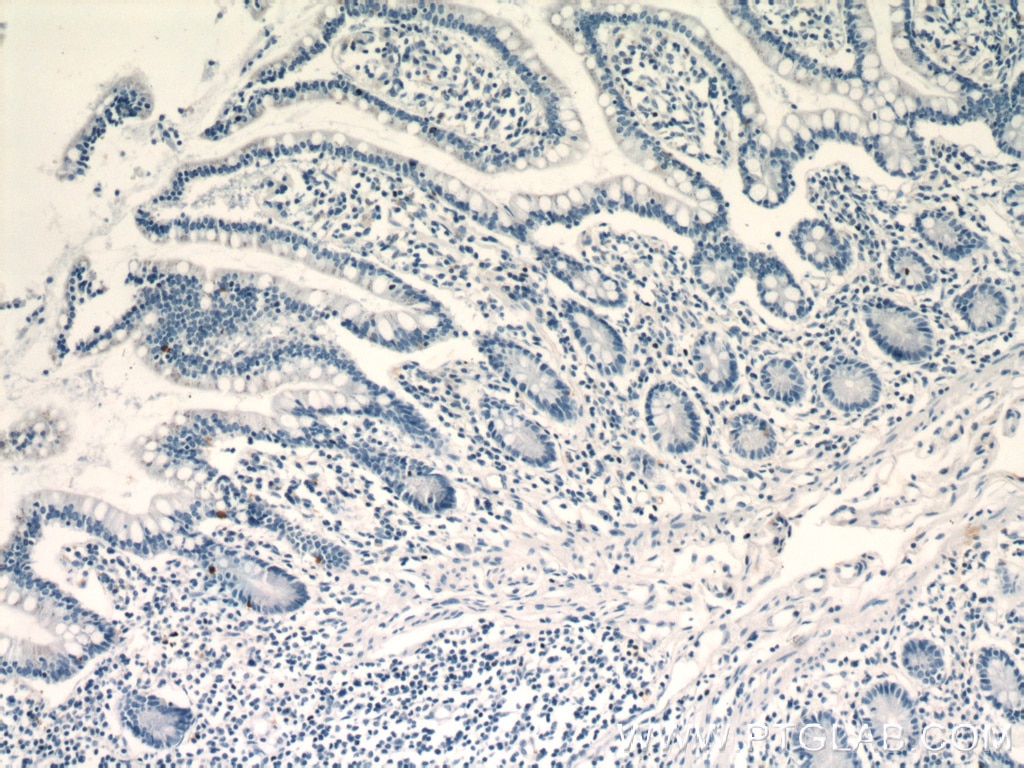 Immunohistochemistry (IHC) staining of human small intestine tissue using LGR5 Polyclonal antibody (21833-1-AP)