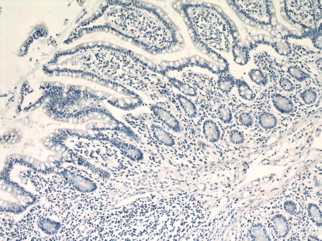 IHC staining of human small intestine using 21833-1-AP