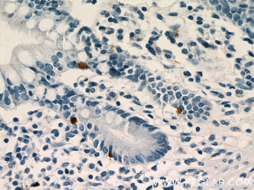 Immunohistochemistry (IHC) staining of human small intestine tissue using LGR5 Polyclonal antibody (21833-1-AP)