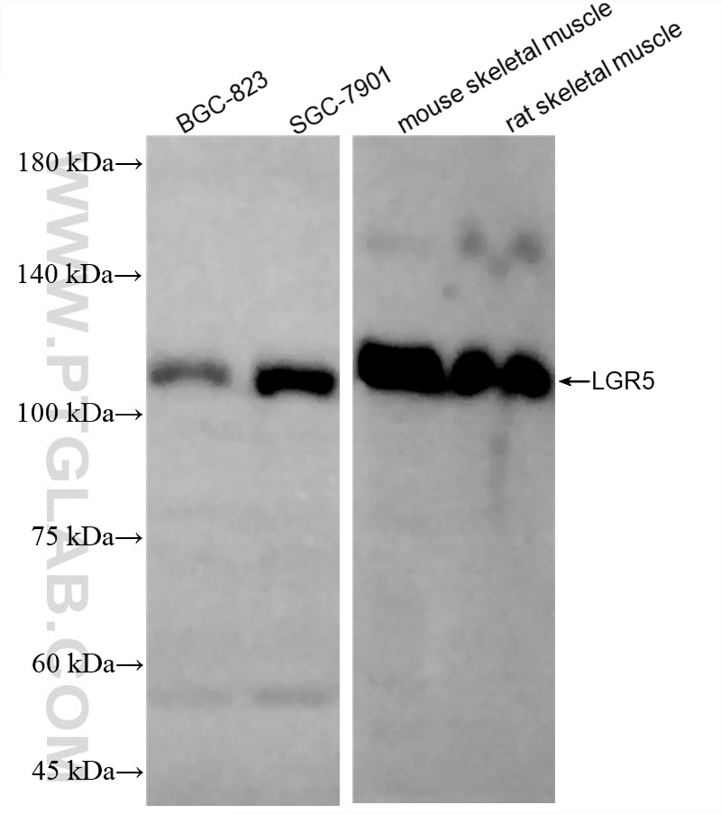 Western Blot (WB) analysis of various lysates using LGR5 Recombinant monoclonal antibody (86627-1-RR)