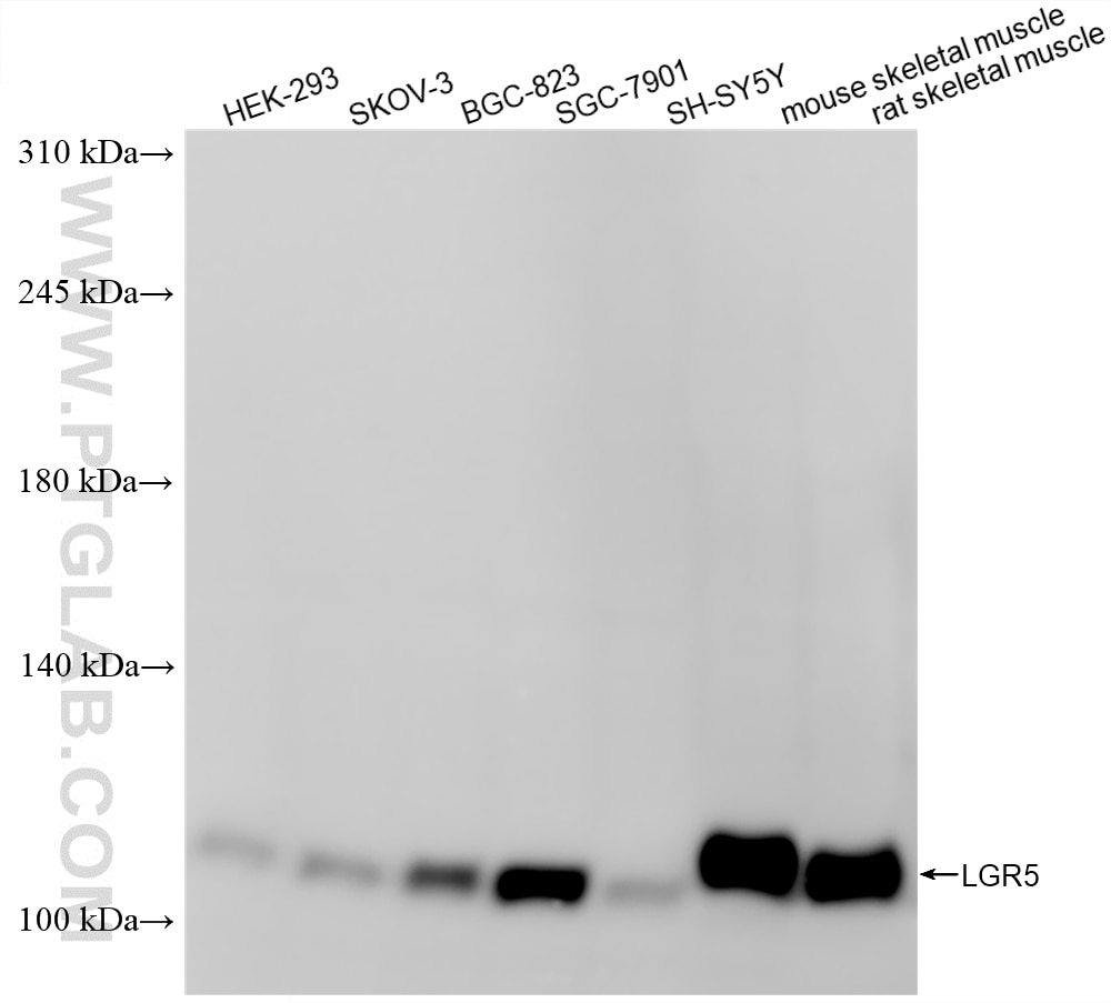 Western Blot (WB) analysis of various lysates using LGR5 Recombinant monoclonal antibody (86627-1-RR)