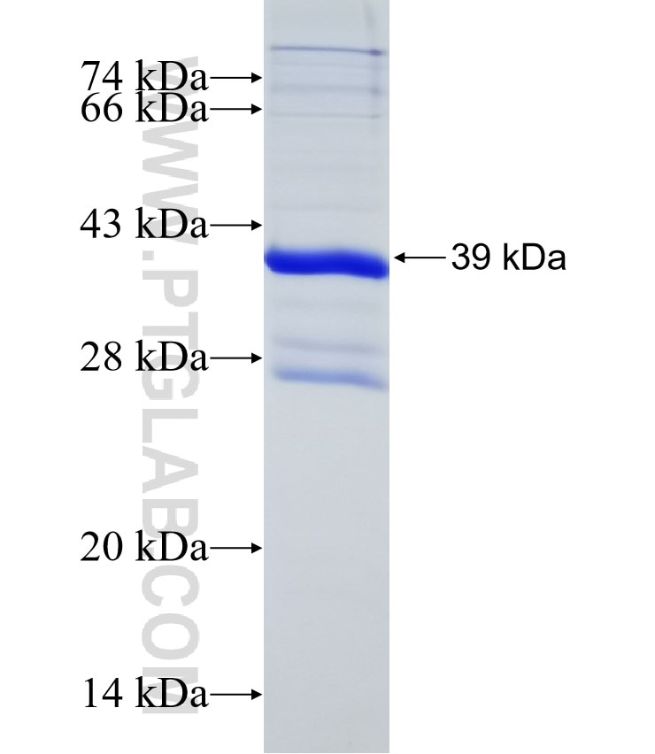 LGR5 fusion protein Ag31625 SDS-PAGE