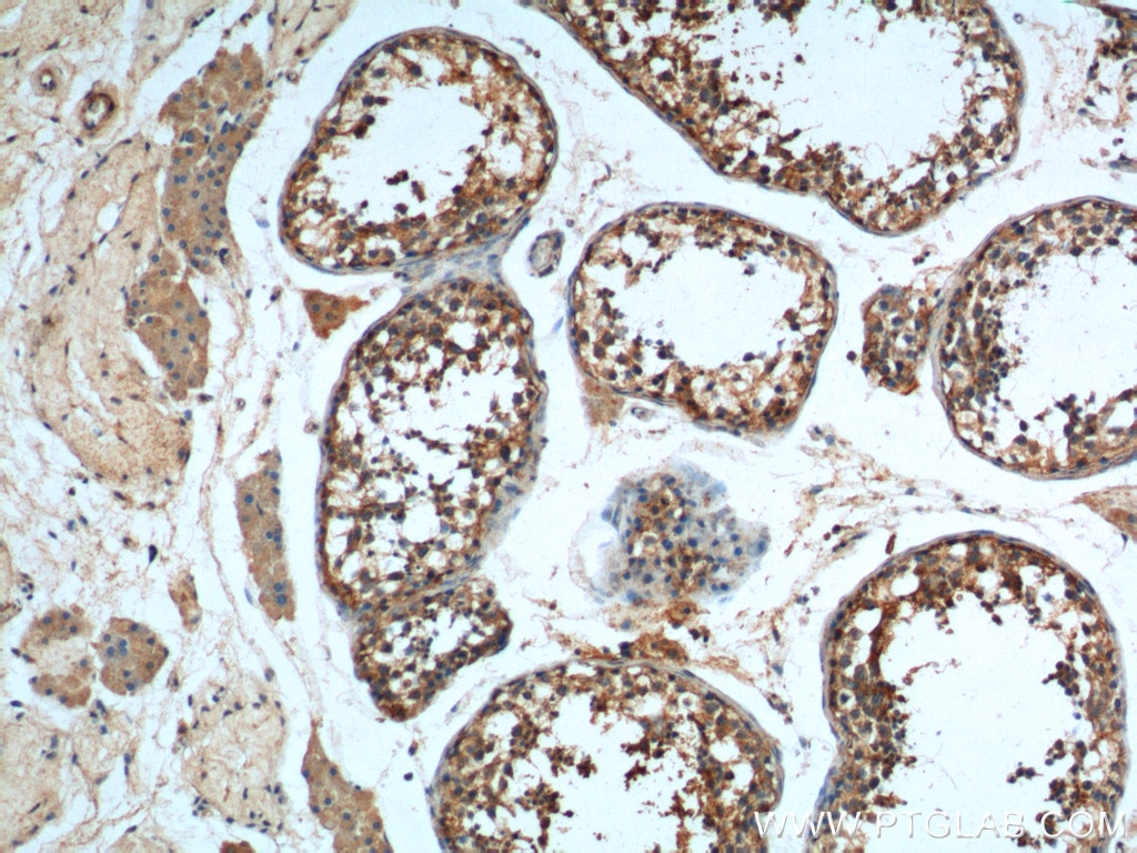 Immunohistochemistry (IHC) staining of human testis tissue using LGR6 Polyclonal antibody (17658-1-AP)