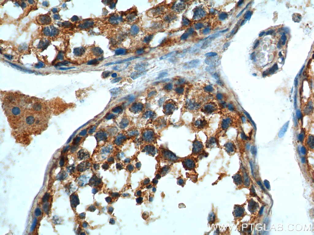 Immunohistochemistry (IHC) staining of human testis tissue using LGR6 Polyclonal antibody (17658-1-AP)