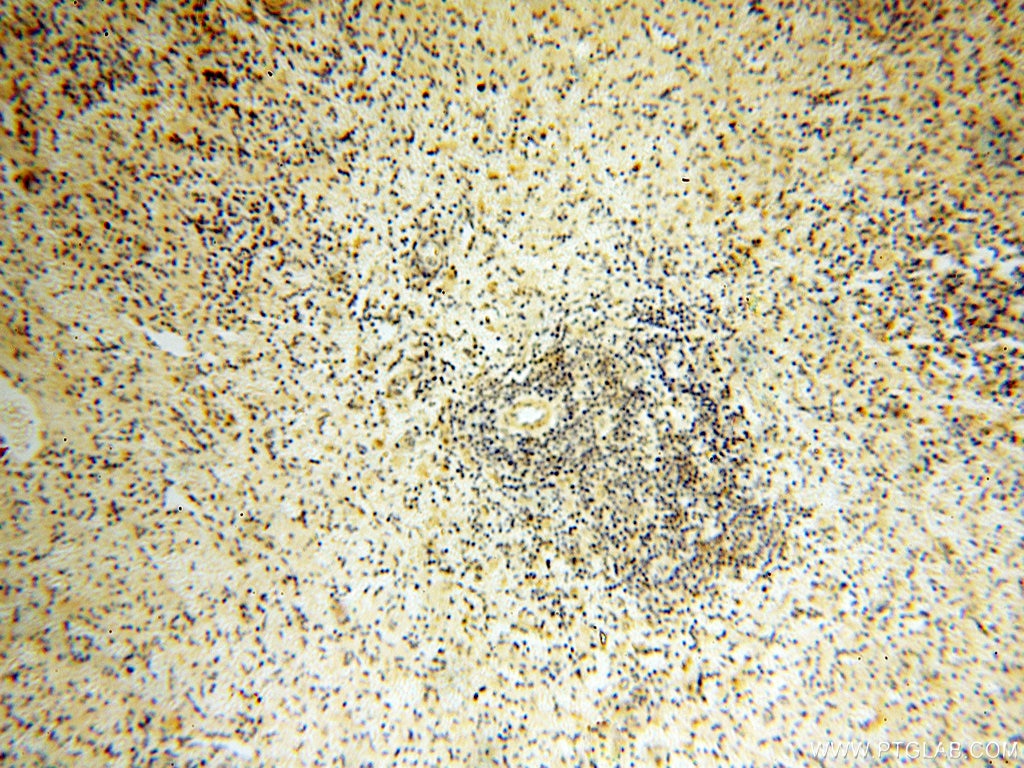 Immunohistochemistry (IHC) staining of human spleen tissue using LGR6 Polyclonal antibody (17658-1-AP)