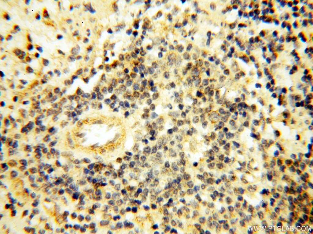 Immunohistochemistry (IHC) staining of human spleen tissue using LGR6 Polyclonal antibody (17658-1-AP)