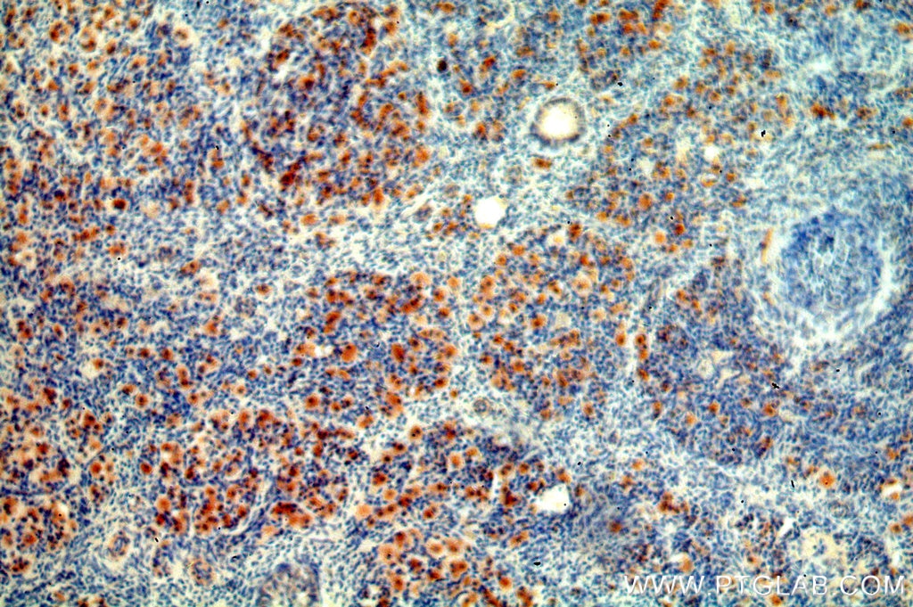 Immunohistochemistry (IHC) staining of human ovary tissue using LGR6 Polyclonal antibody (17658-1-AP)