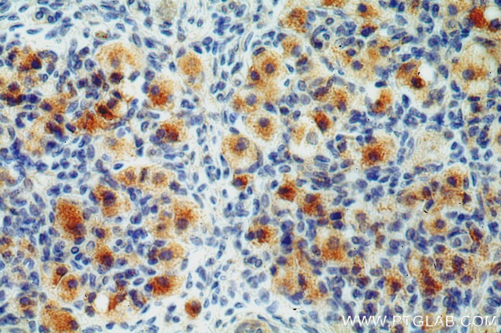 Immunohistochemistry (IHC) staining of human ovary tissue using LGR6 Polyclonal antibody (17658-1-AP)