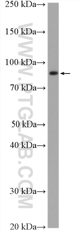 Western Blot (WB) analysis of HUVEC cells using LGR6 Polyclonal antibody (17658-1-AP)