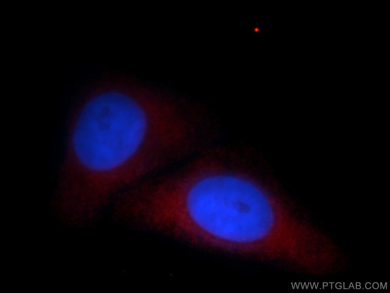 Immunofluorescence (IF) / fluorescent staining of HepG2 cells using LGTN Polyclonal antibody (12840-1-AP)