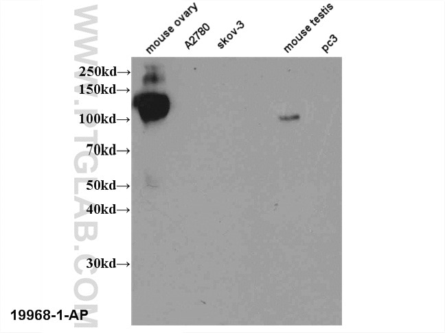 WB analysis of multi-cells/tissue using 19968-1-AP