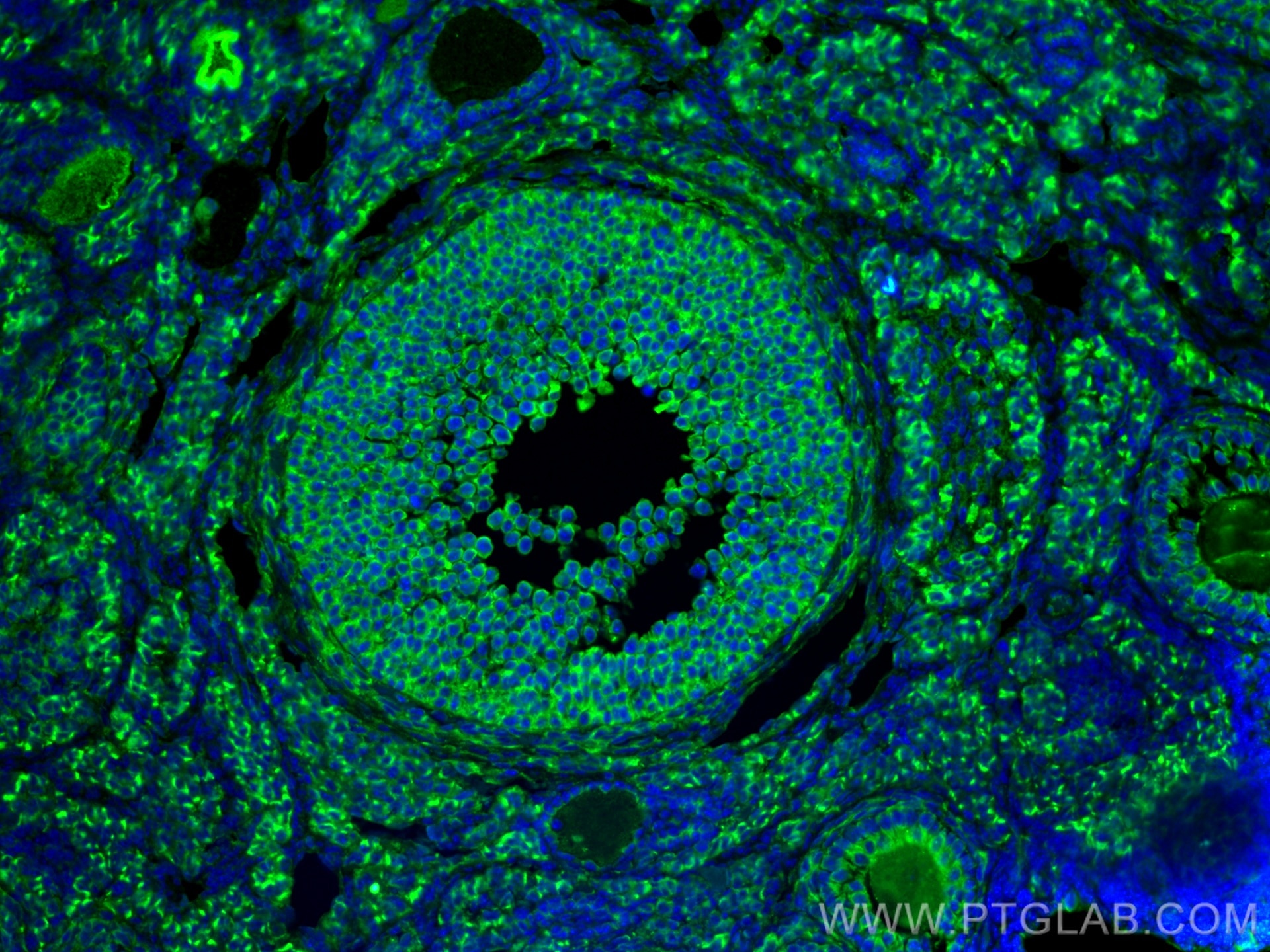 Immunofluorescence (IF) / fluorescent staining of mouse ovary tissue using LHCGR Polyclonal antibody (19968-1-AP)