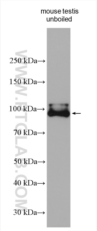 Western Blot (WB) analysis of various lysates using LHCGR Polyclonal antibody (19968-1-AP)
