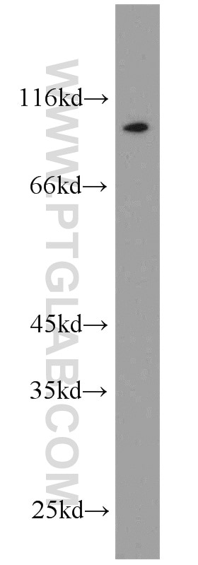 Western Blot (WB) analysis of mouse ovary tissue using LHCGR Polyclonal antibody (19968-1-AP)