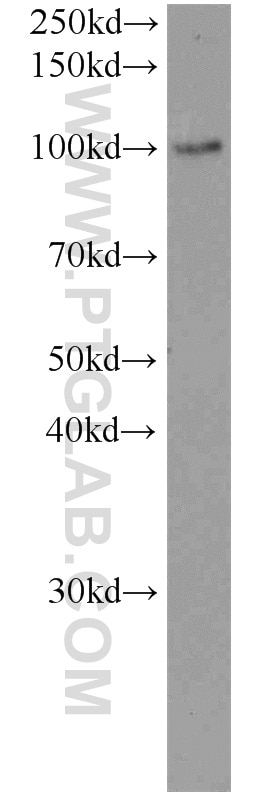 LHCGR Polyclonal antibody