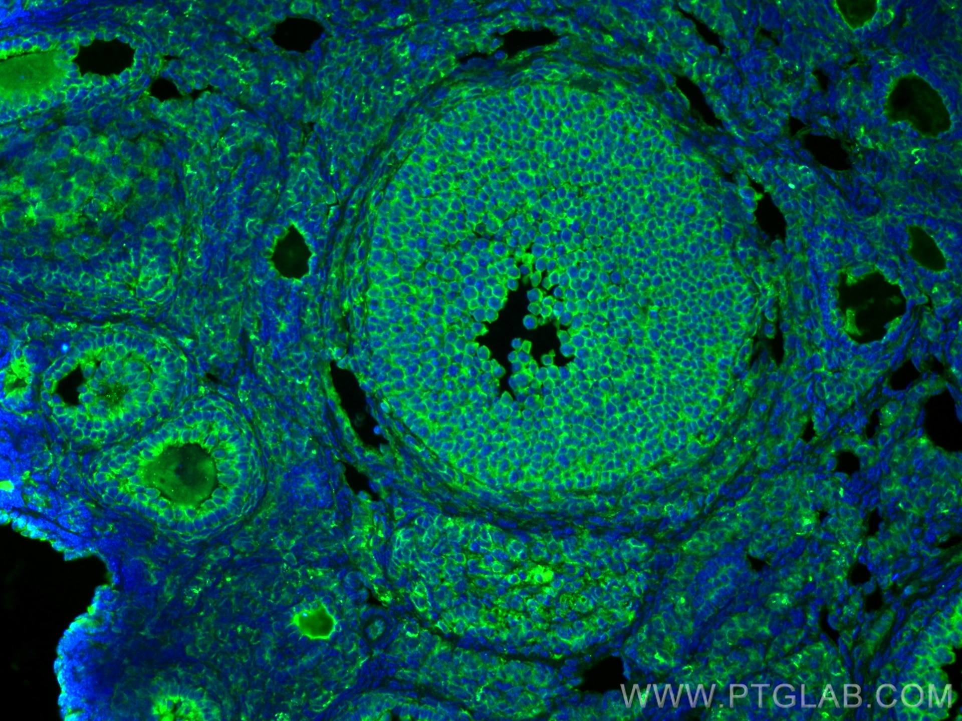Immunofluorescence (IF) / fluorescent staining of mouse ovary tissue using LHCGR Polyclonal antibody (26424-1-AP)