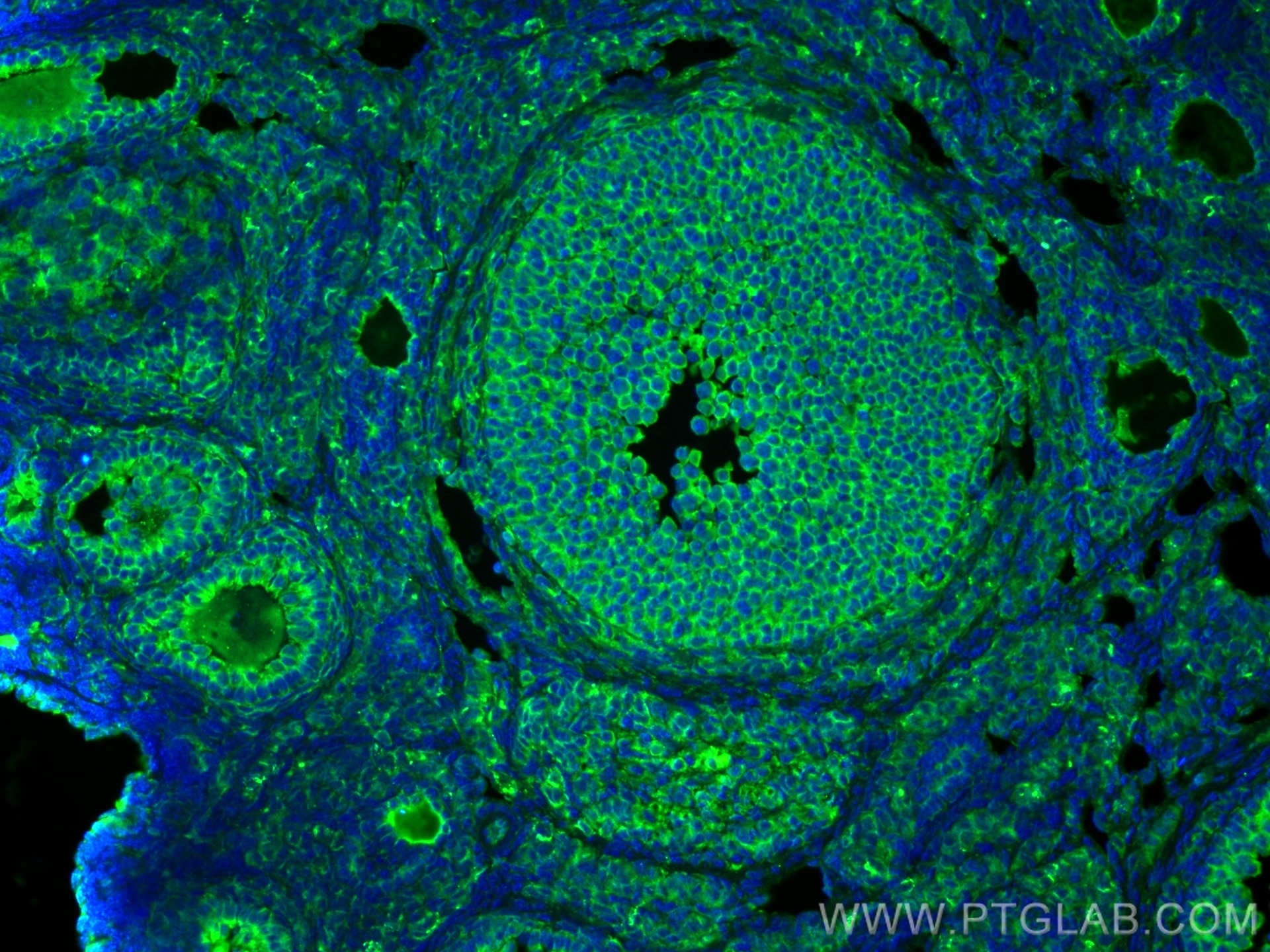 Immunofluorescence (IF) / fluorescent staining of mouse ovary tissue using LHCGR Polyclonal antibody (26424-1-AP)