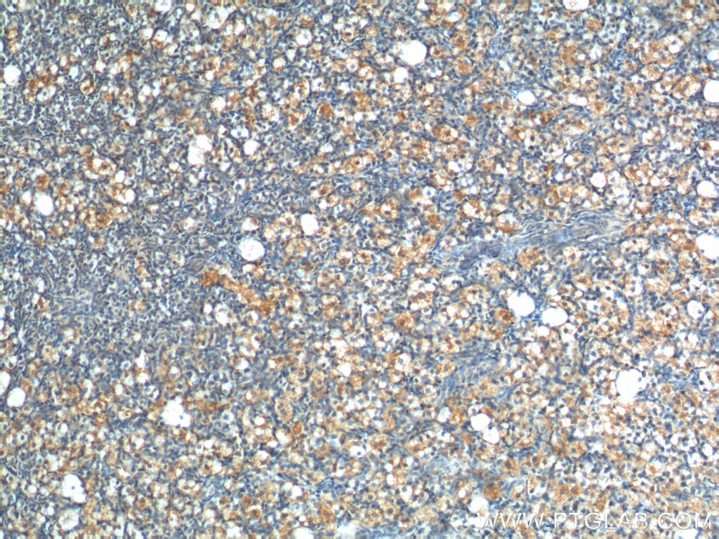 Immunohistochemistry (IHC) staining of human ovary tissue using LHCGR Polyclonal antibody (26424-1-AP)