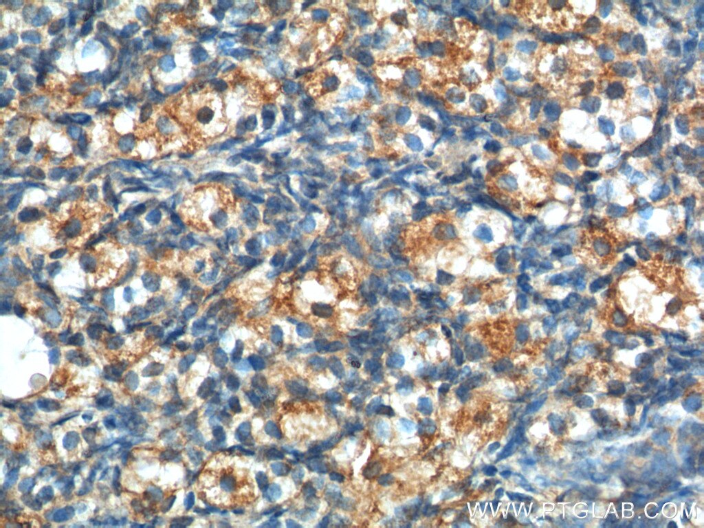 Immunohistochemistry (IHC) staining of human ovary tissue using LHCGR Polyclonal antibody (26424-1-AP)