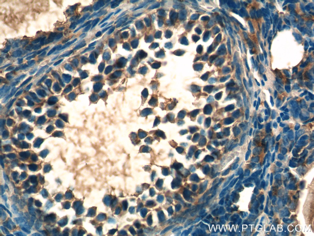 Immunohistochemistry (IHC) staining of mouse ovary tissue using LHCGR Polyclonal antibody (26424-1-AP)