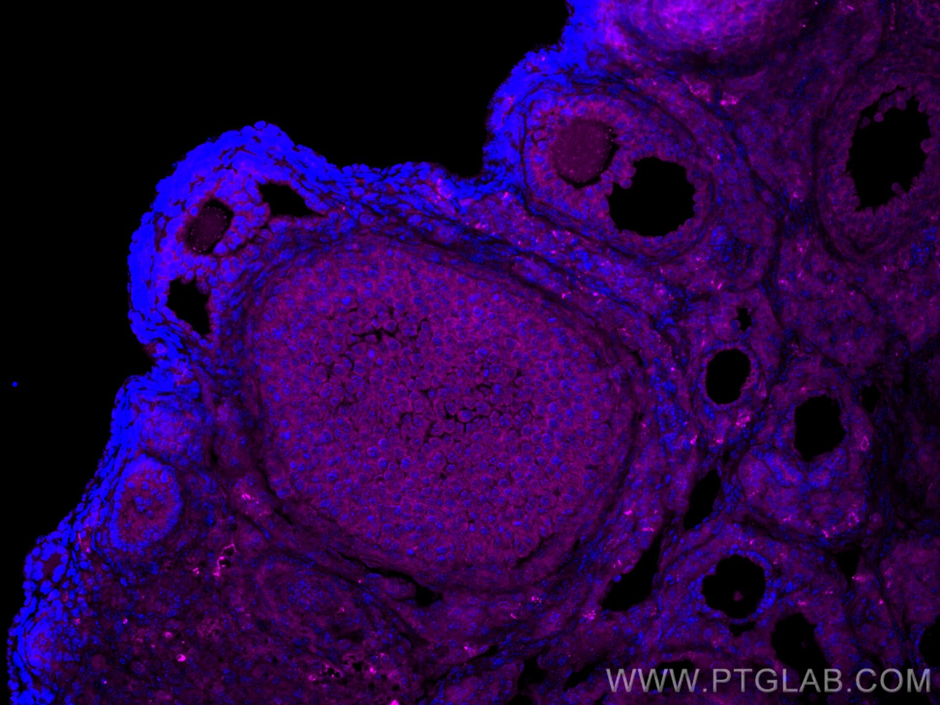 Immunofluorescence (IF) / fluorescent staining of mouse ovary tissue using CoraLite® Plus 647-conjugated LHCGR Polyclonal ant (CL647-26424)