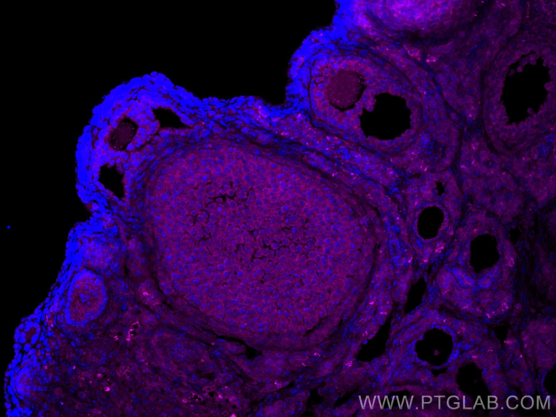 IF Staining of mouse ovary using CL647-26424