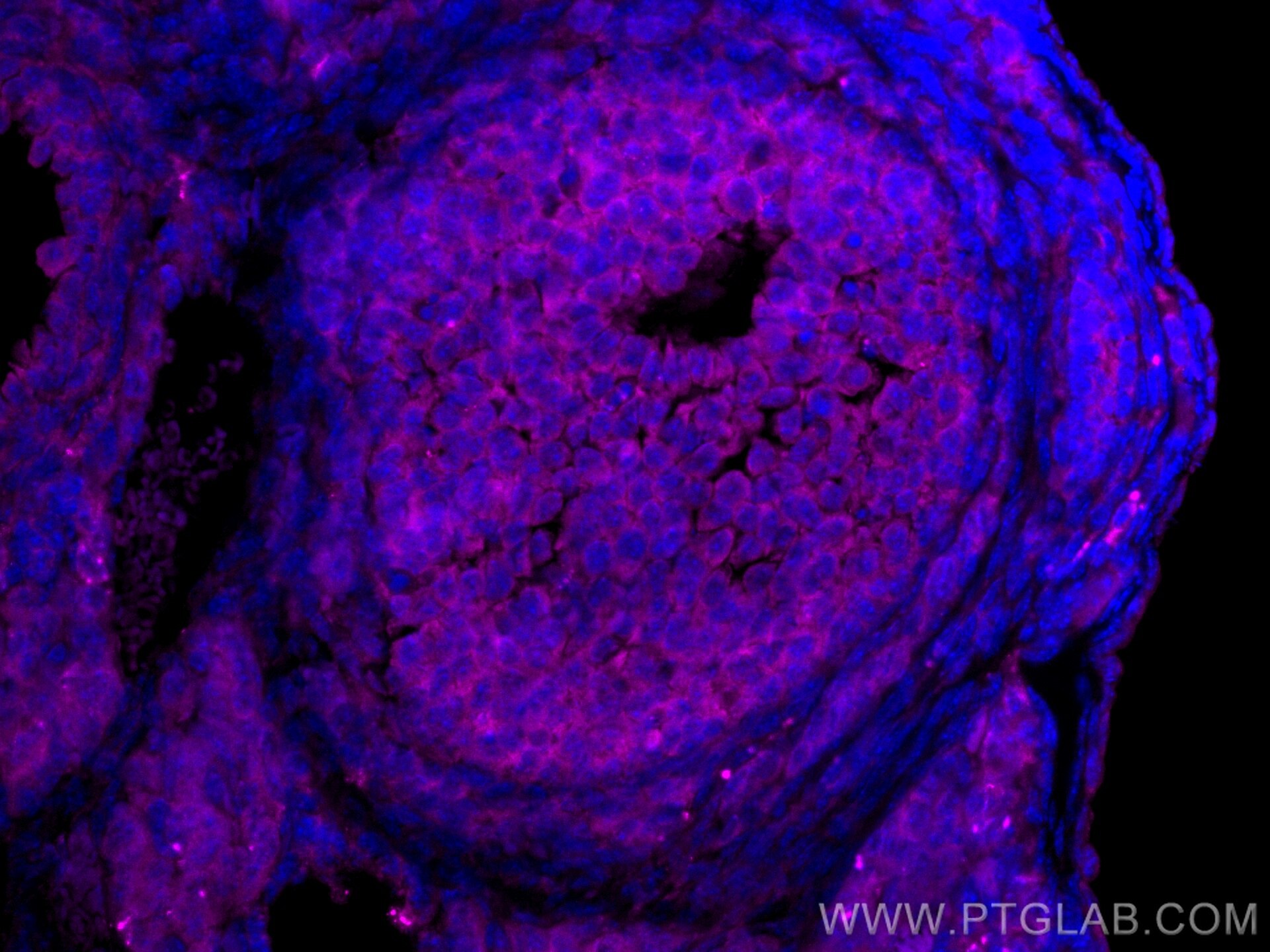 IF Staining of mouse ovary using CL647-26424