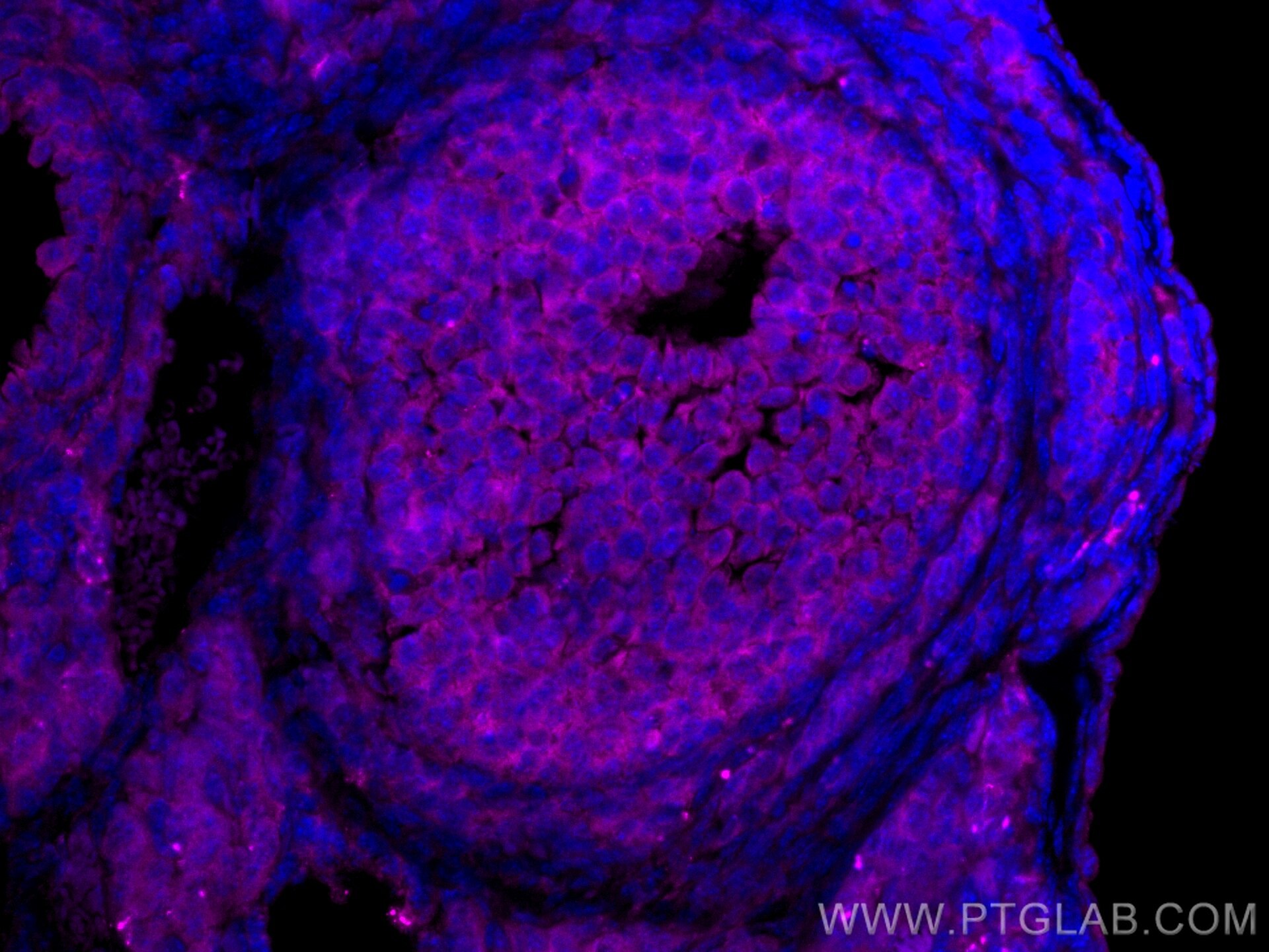 Immunofluorescence (IF) / fluorescent staining of mouse ovary tissue using CoraLite® Plus 647-conjugated LHCGR Polyclonal ant (CL647-26424)