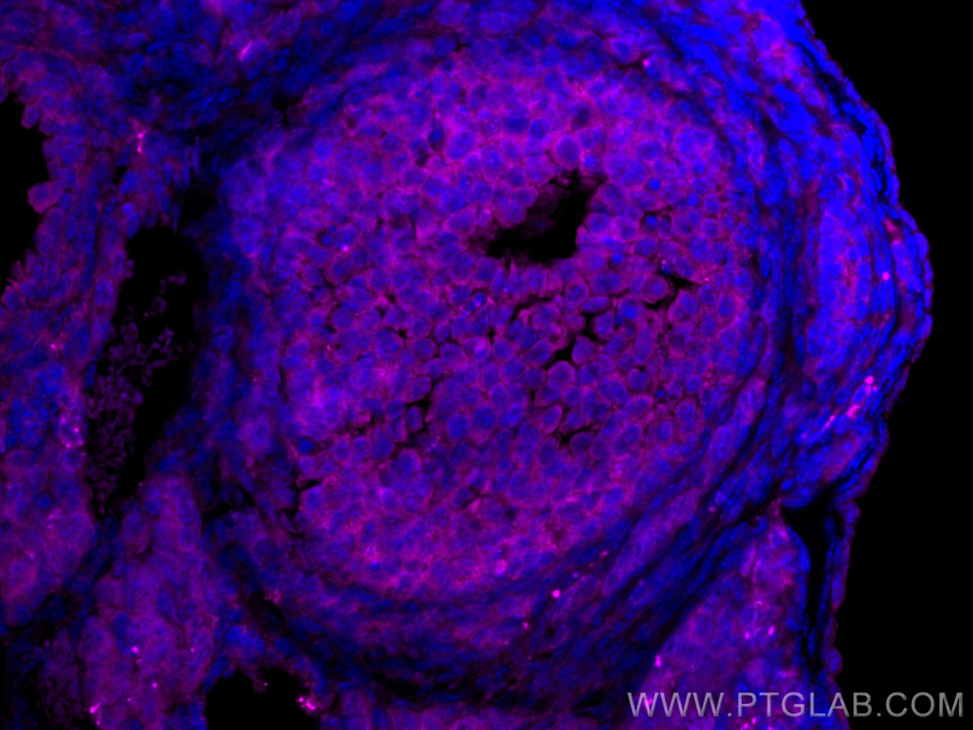 Immunofluorescence (IF) / fluorescent staining of mouse ovary tissue using CoraLite® Plus 647-conjugated LHCGR Polyclonal ant (CL647-26424)