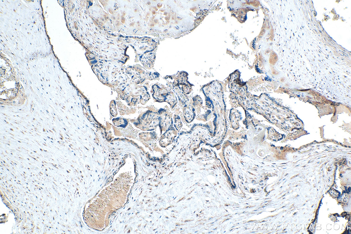Immunohistochemistry (IHC) staining of human placenta tissue using LHFPL1 Polyclonal antibody (21005-1-AP)