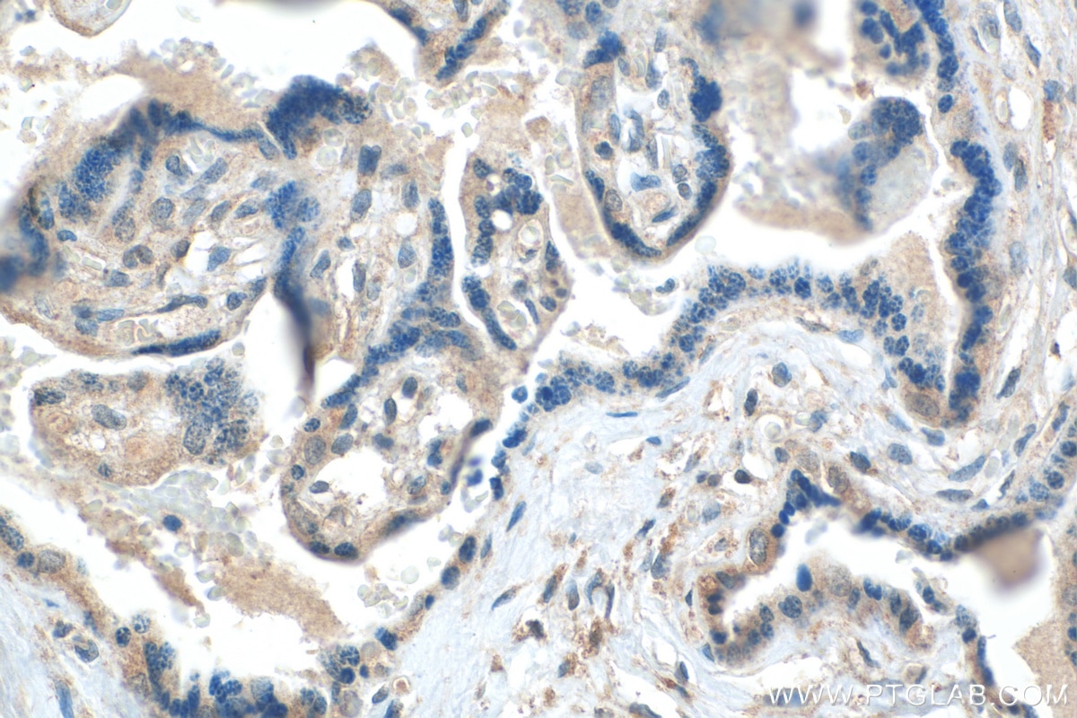 Immunohistochemistry (IHC) staining of human placenta tissue using LHFPL1 Polyclonal antibody (21005-1-AP)
